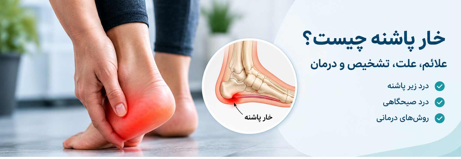 خار پاشنه چیست؟ علائم، علت، تشخیص و درمان خار پاشنه