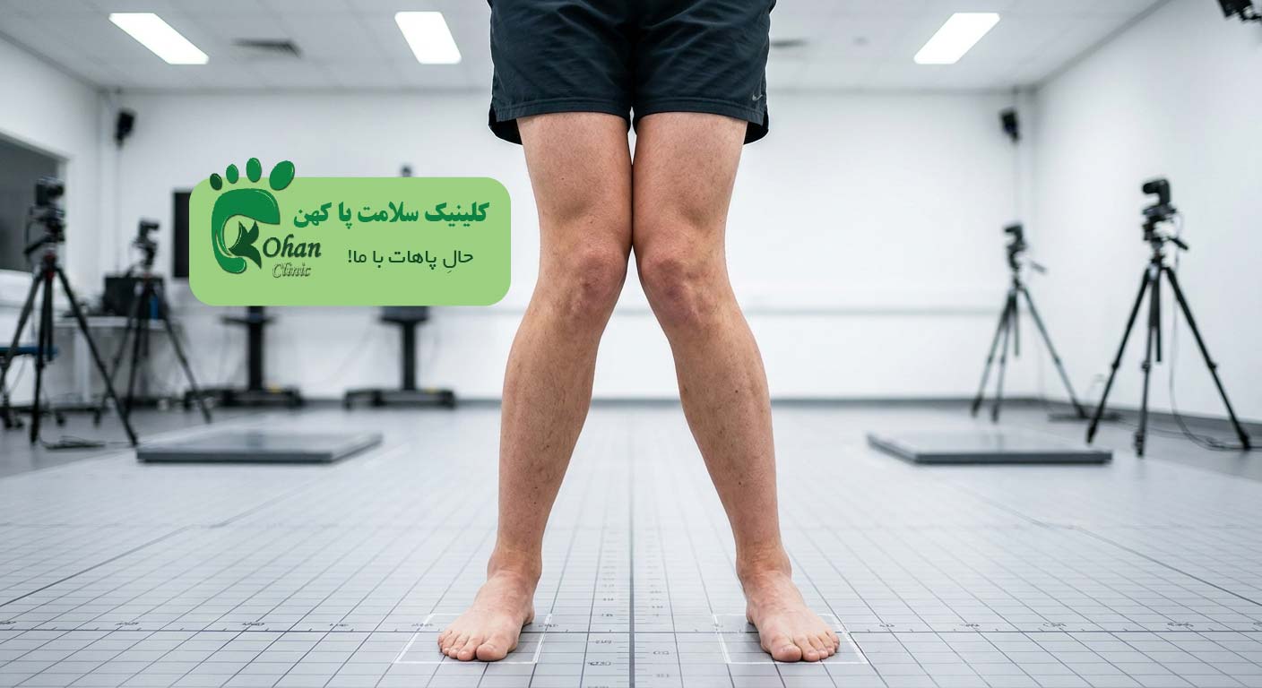 زانو ضربدری