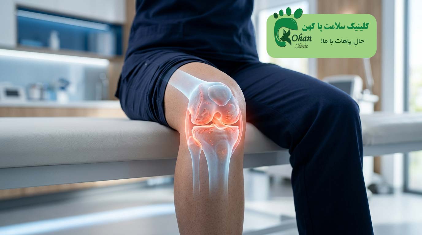 ساییدگی مفصل زانو